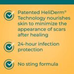 Antibiotic Original Ointment 0.50 oz (Pack of 3) - Image 3