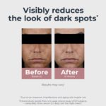 Radiant Tone Dual Serum Dark Spot Corrector - Image 5
